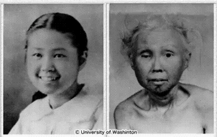 Premature Aging: Inside the NAD+ Trials for People Whose Clock Runs Fast 2 image